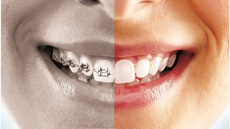 10 Common Myths About Oral Health