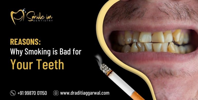Reasons Why Smoking Is Bad For Your Teeth