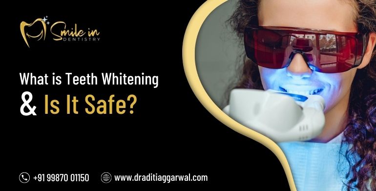 What is teeth whitening and is it safe?